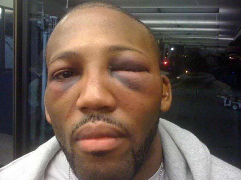 john-howard-eye1