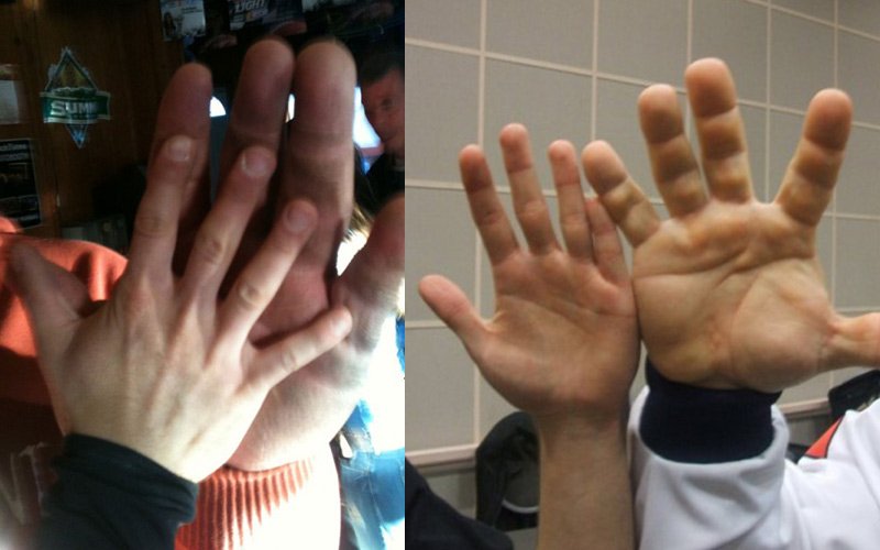 The smaller hand in each of these pictures belongs to Josh Handeland, another competitive arm wrestler.