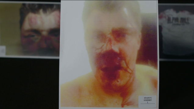 The injuries of Corey Thomas, caused by War Machine. 