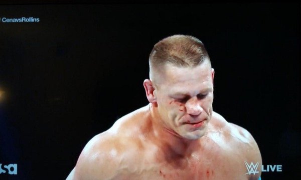 John Cena broken nose 2