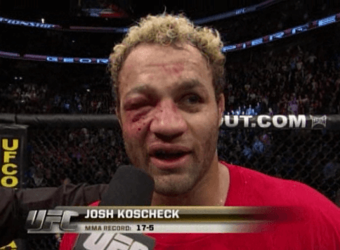 josh-koscheck-eye