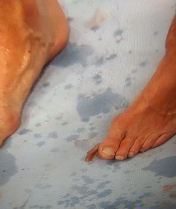 michael bisping foot