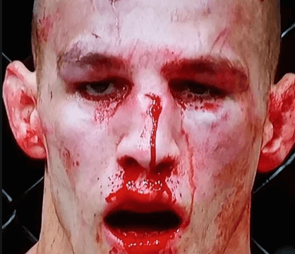 rory-macdonald-ufc189