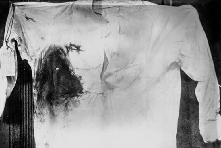 It's not like he was shot in the foot, either. Here's Teddy's shirt after he was shot.