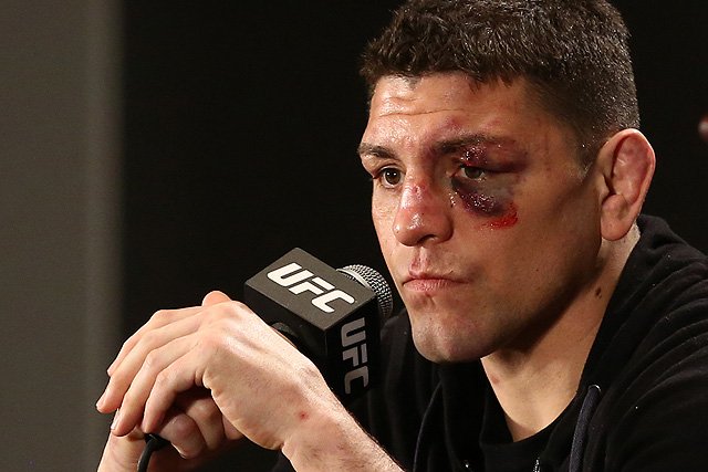 The ridiculous Diaz suspension is a true black eye to the sport.