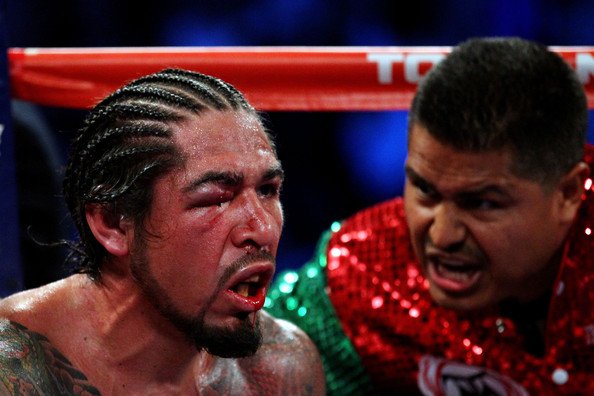 Antonio Margarito showing the effects of Cotto's punches
