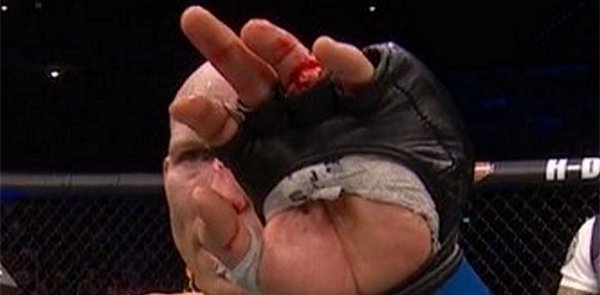 That's some nasty stuff right there. Photo by Sherdog.com on Twitter.