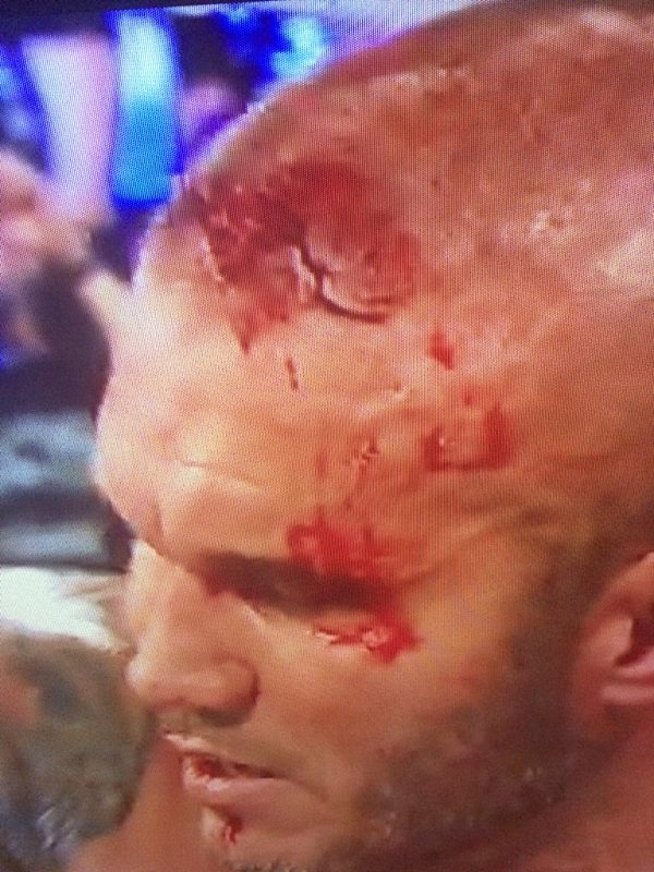 That is one GNARLY cut on Orton's. Photo by Alex Nino on Twitter @AlexNino.