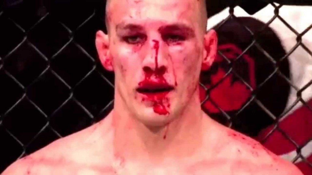 Robbie Lawler did THIS to Rory MacDonald, so it's hard to blame him for being mad about possible PED use.