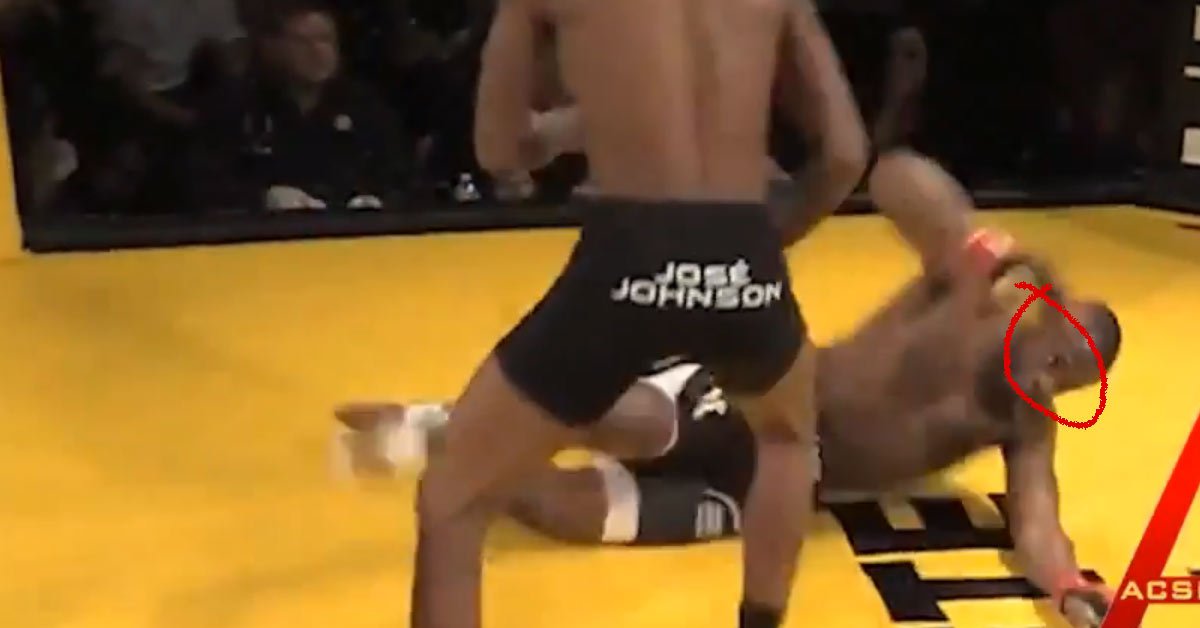 mma-fighter-loses-eye