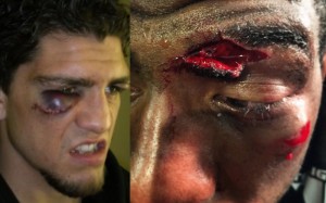 messed-up-eyes