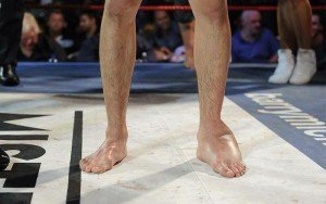 messed-up-foot
