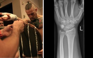 conor-hand