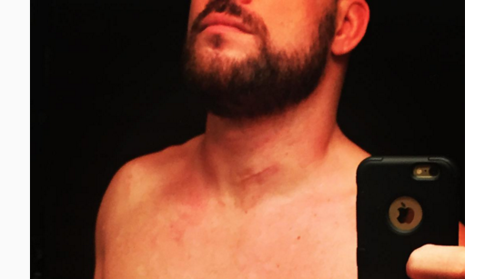 neck