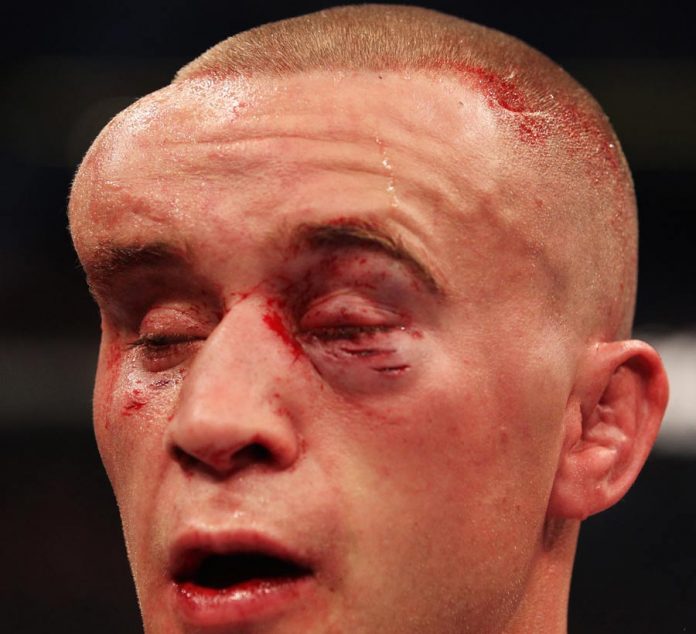 Jose Aldo - Mark Hominick