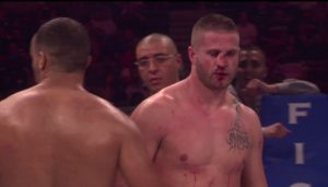 KO and Broken Nose