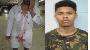 Shakur Stevenson Bloodied after fight