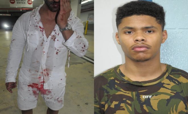 Shakur Stevenson Bloodied after fight
