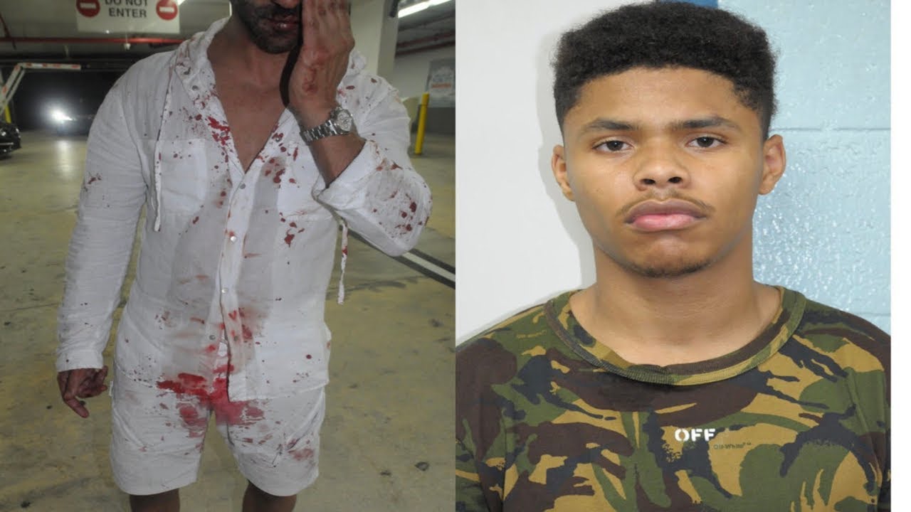 Shakur Stevenson Bloodied after fight