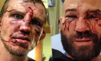 Jason Knight and Artem Lobov were a picture after their fight.