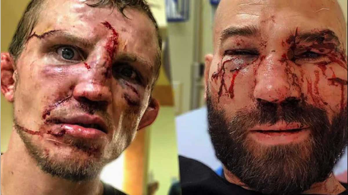 Jason Knight and Artem Lobov were a picture after their fight.
