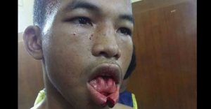 muay-thai-split-lip-feat2