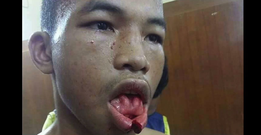 muay-thai-split-lip-feat2