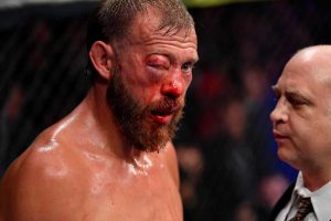 Donald Cerrone With Swollen Eye Injury at UFC 238