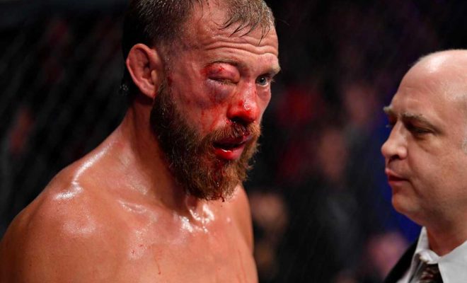 Donald Cerrone With Swollen Eye Injury at UFC 238